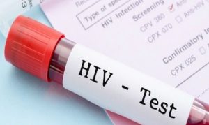 ULTIM’ORA – Untore HIV condannato dalla Cassazione ma si vuole un rialzo pena!