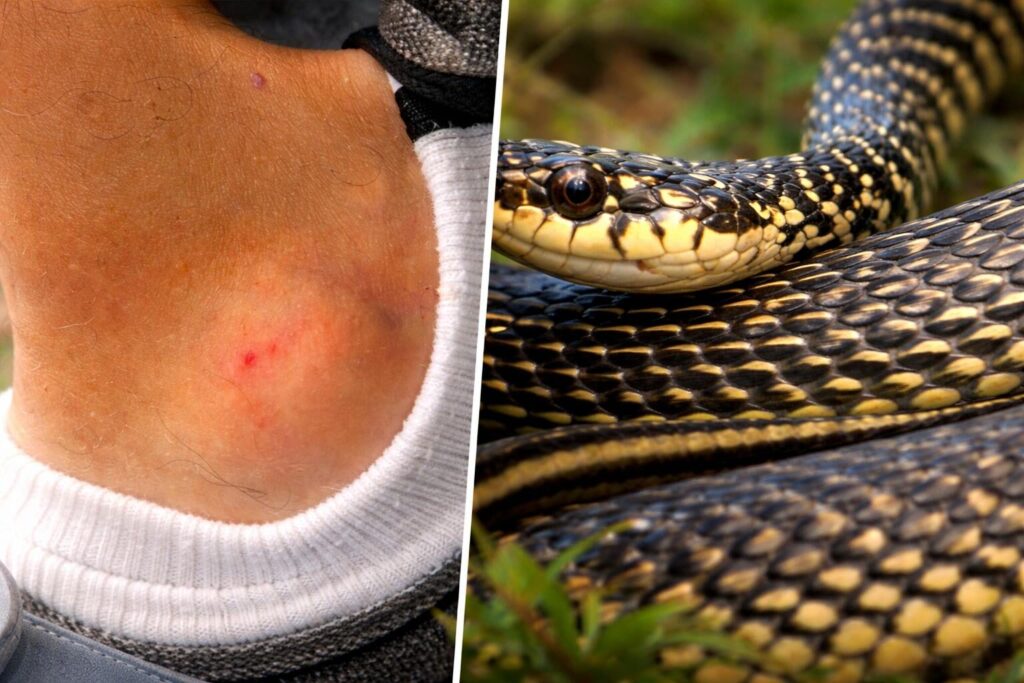 Morso di serpente a Casal Palocco: un simbolo di conflitto tra natura e urbanizzazione a Roma