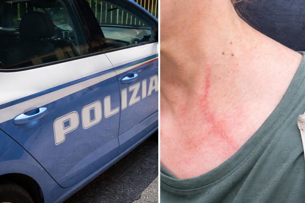 Rapina a Centocelle: l’intervento dei passanti cambia le regole del gioco
