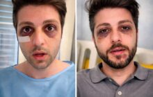 Aggressione a Ash Kamangar: la Roma degli influencer è veramente al sicuro?