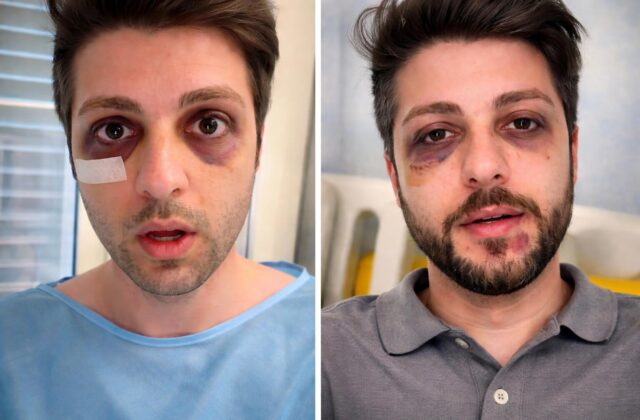 Aggressione a Ash Kamangar: la Roma degli influencer è veramente al sicuro?