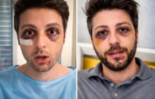 Sicurezza a Roma: l’aggressione a Guardian of Rome e il risvolto della giustizia